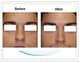Slider image (5) Aesthetic Cosmetic Plastic Surgery Center Bolivia - SensualBodyDream
